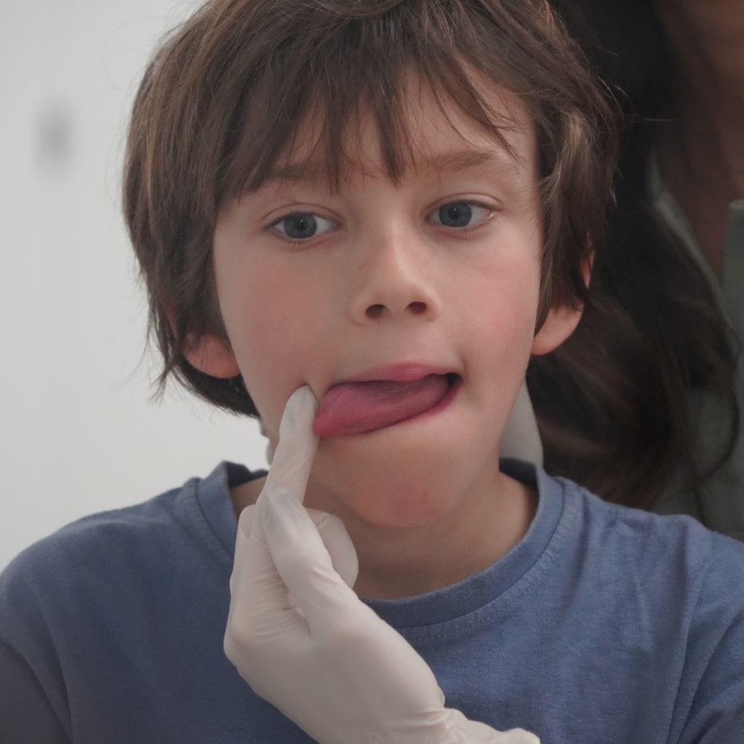 Dislalia en niños tratada con logopedia