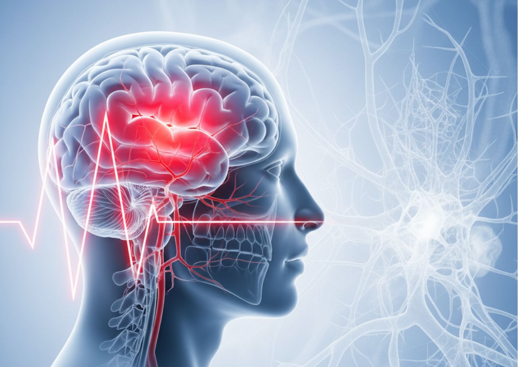 Ictus migrañoso, causas, síntomas y tratamiento