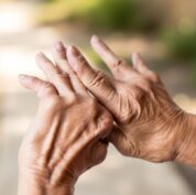 artritis en las manos