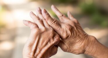 artritis en las manos