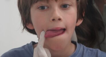 logopeda dislalia gijon