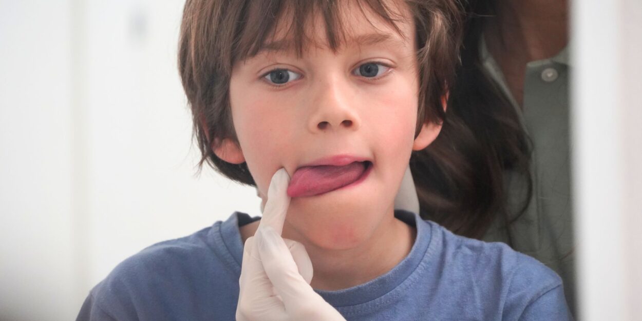 logopedia infantil gijon asturias