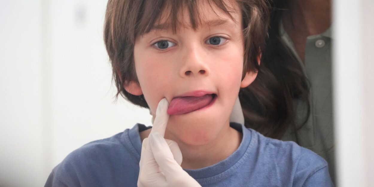 logopedia infantil gijon asturias